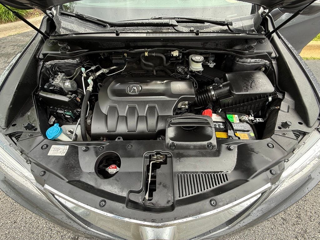 2018 Acura RDX Technology Package